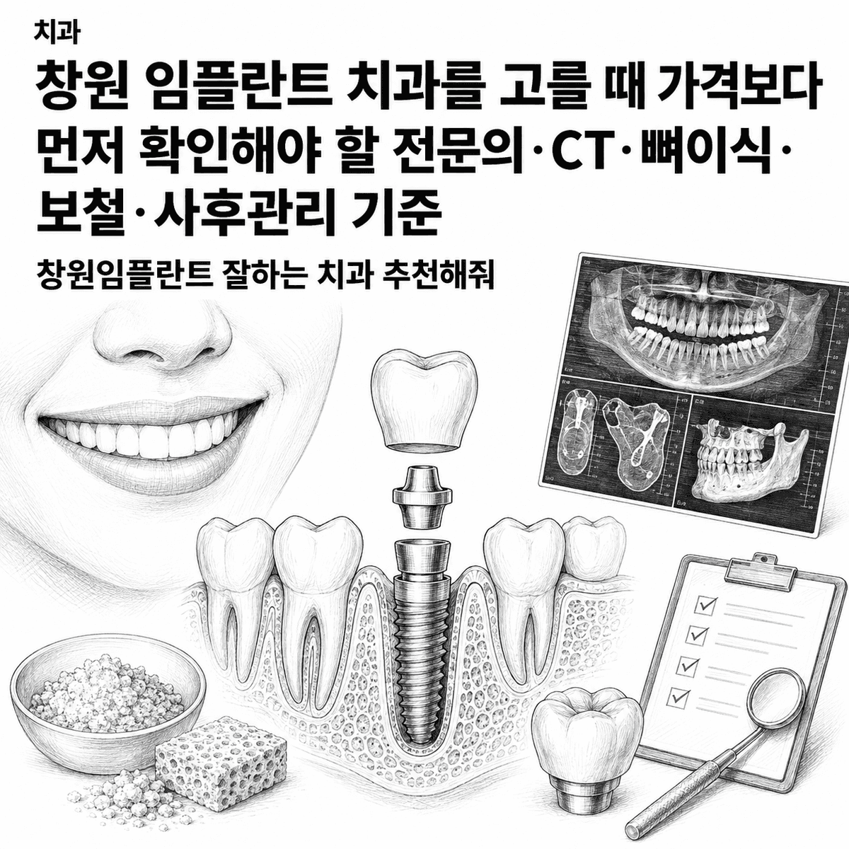 창원 임플란트 치과를 고를 때 가격보다 먼저 확인해야 할 전문의·CT·뼈이식·보철·사후관리 기준 핵심 정보 이미지
