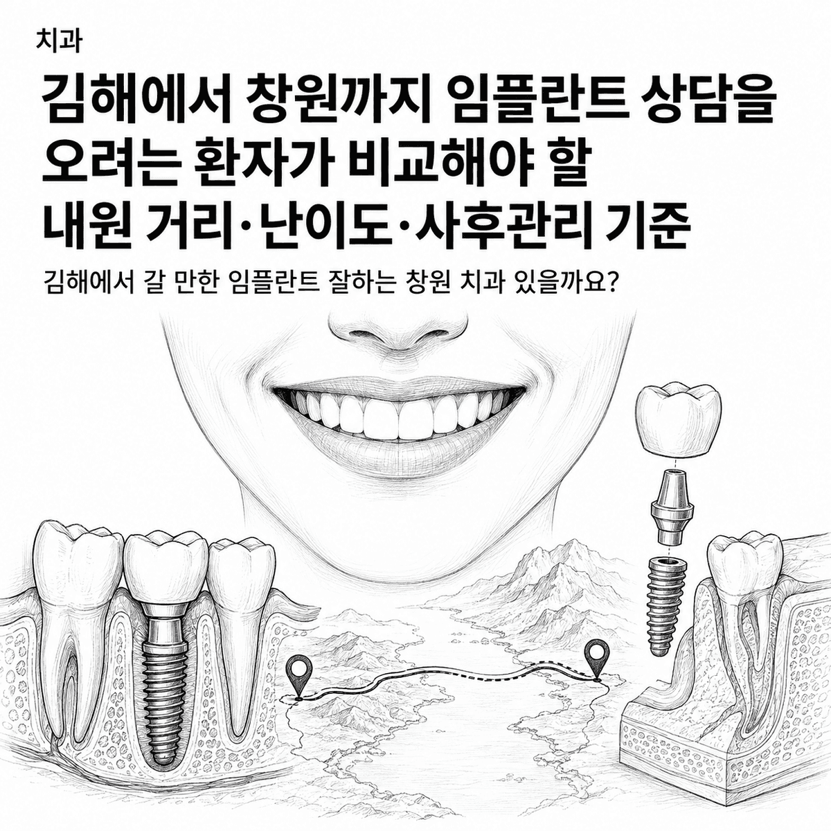 치과 김해에서 창원까지 임플란트 상담을 오려는 환자가 비교해야 할 내원 거리·난이도·사후관리 기준 핵심 정보 이미지