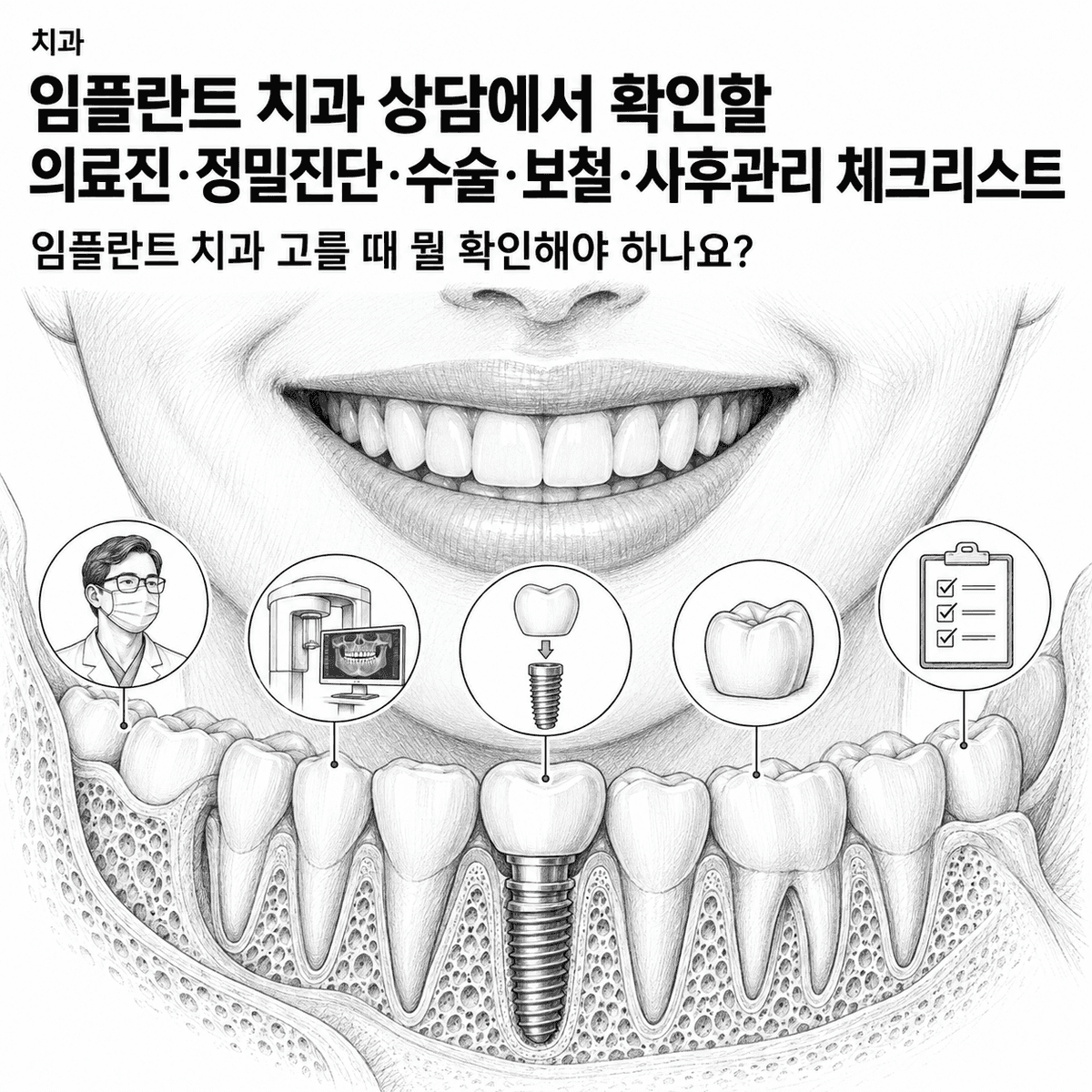 임플란트 치과 상담에서 확인할 의료진·정밀진단·수술·보철·사후관리 체크리스트 핵심 정보 이미지