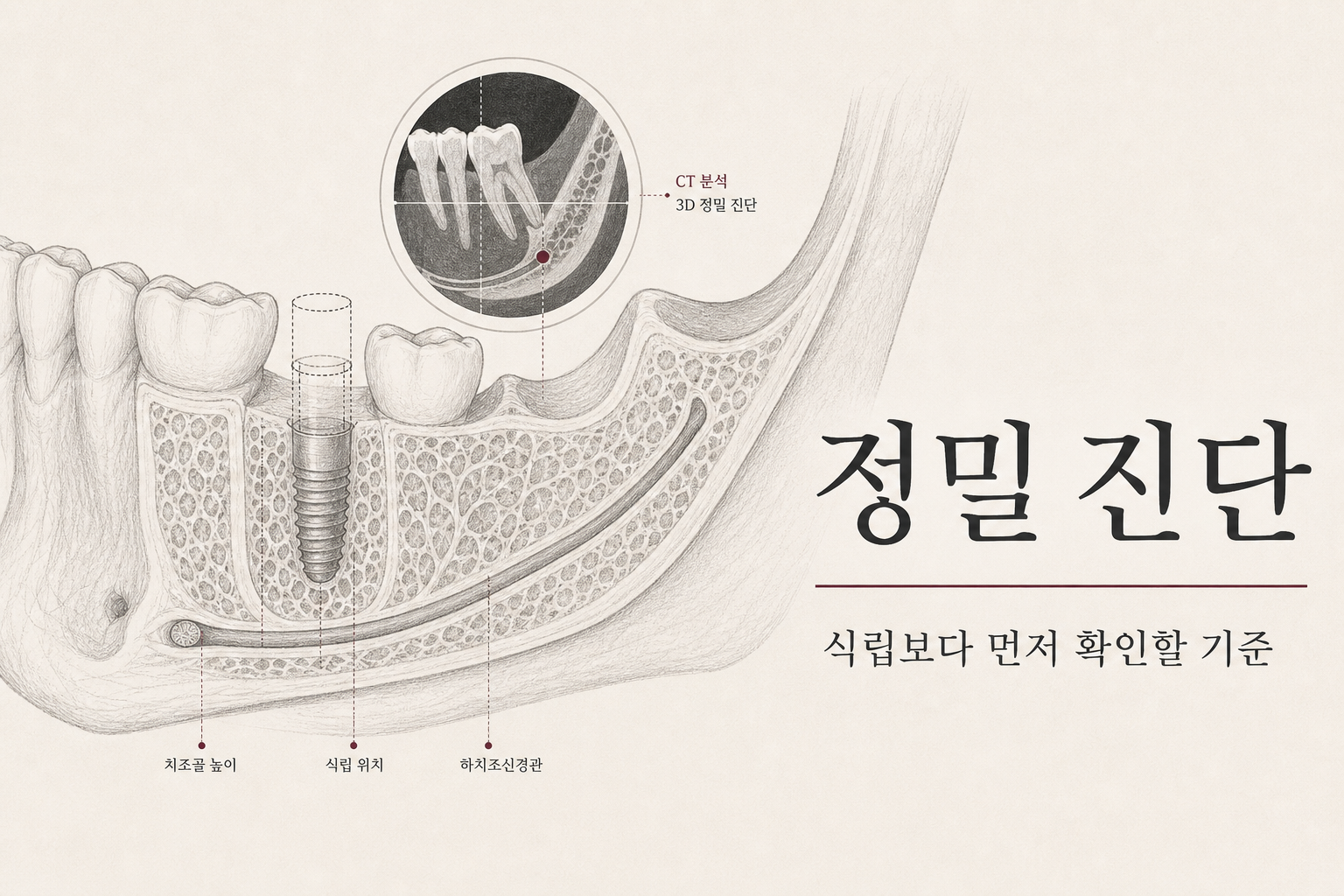 임플란트 정밀 진단 고급 해부학 라인드로잉 썸네일