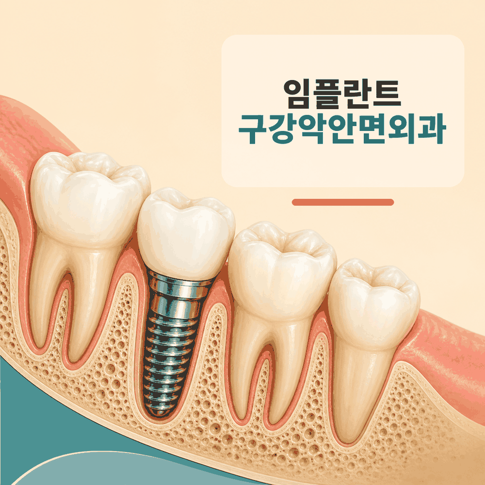치과 구강악안면외과 전문의가 임플란트에서 특히 중요해지는 고난도 케이스와 일반 임플란트와의 차이 핵심 정보 이미지